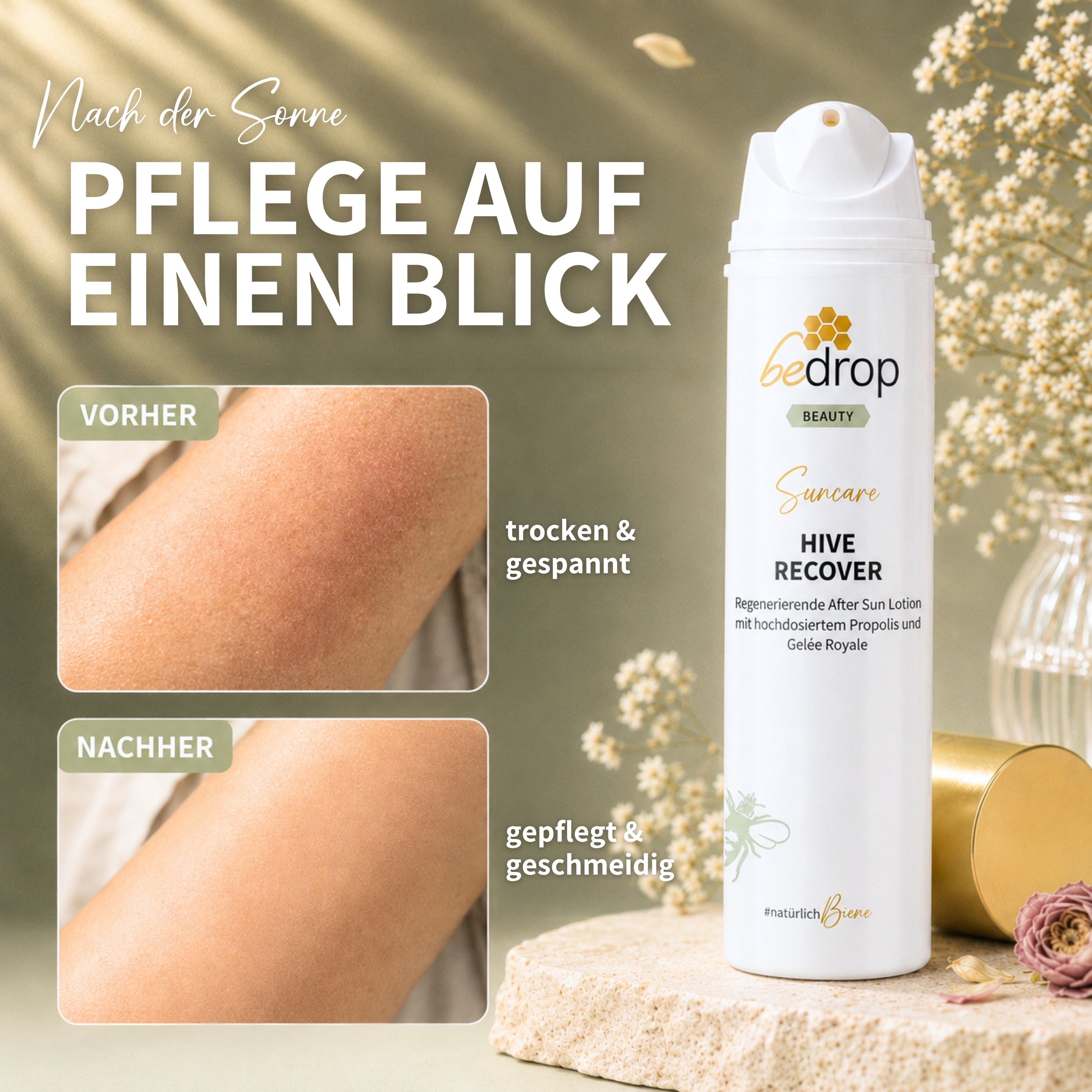 Value set: 6x HIVE RECOVER - regenerating after sun lotion with high-dose royal jelly & propolis - 200ml